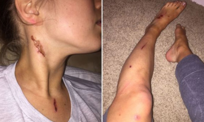 Gece kulübünde asitli saldırıya 20 yıl hapis