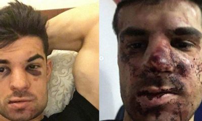 Zenitli futbolcu Denis Terentiev’e arabasının içinde saldırı!