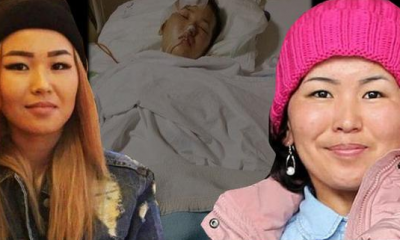 Malikan Nootieva doktorları bile şaşırttı!