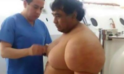 Dalış kazası… Tüm vücudu şişti