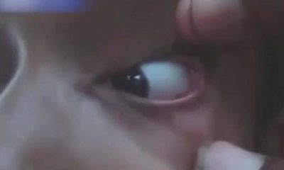 11 yaşındaki çocuğun gözünden çıkanlar herkesi şoke etti!