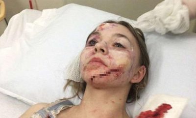 Sette korkunç kaza…