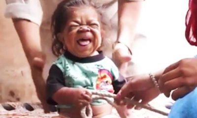 Bebek vücudunda 23 yıl!