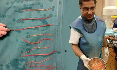 Kadın acılar içinde kıvranıyordu! İçinden devasa solucanlar çıktı