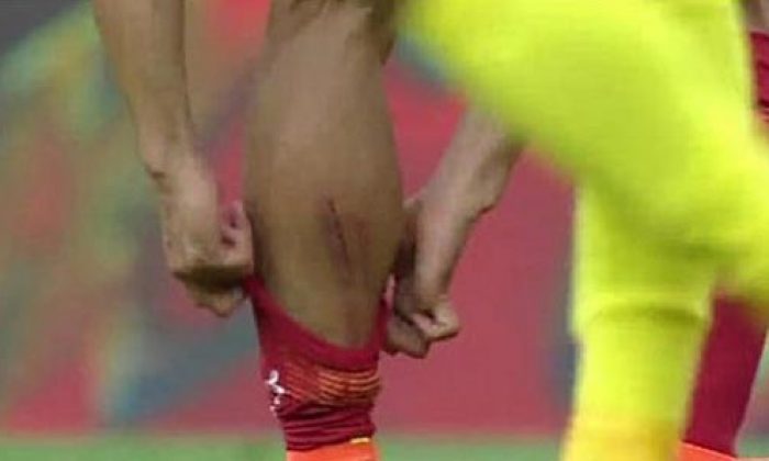 Nagatomo’nun bacağının hali şoke etti