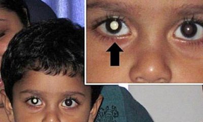 Çekilen fotoğrafla korkunç hastalık ortaya çıktı!