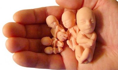 Kürtajdan Sonra Nelere Dikkat Edilmelidir?