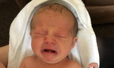 Henüz 12 günlük ve ilk dişini çektirdi