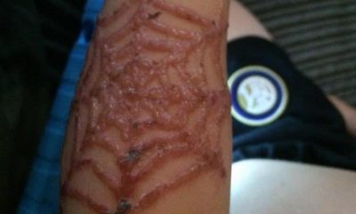 Tatil beldesinde yapılan kına dövme çocuğu bu hale getirdi