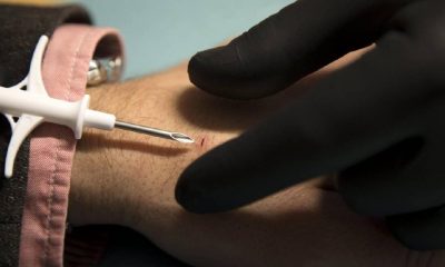 Anahtar, bilet taşıma derdi yok… Ülkede 4 bin kişi eline çip taktırdı