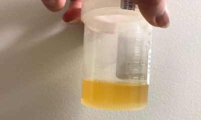 Doktorlar uyardı: İdrarınızı içmeyin