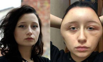 Saç boyası yüzünü tanınmaz hale getirdi