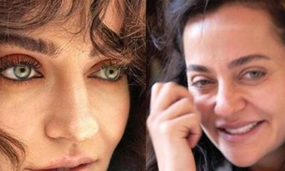 Ünlü oyuncunun yüzü tanınmaz hale gelmişti! Karar verildi