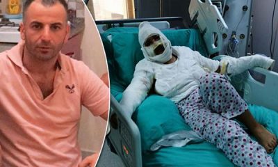 Eski eşini kızgın yağ ile yakan kişiye 23 yıla kadar hapis istemi
