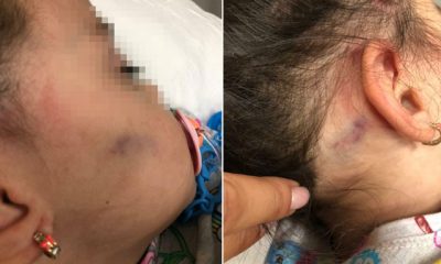 2,5 yaşındaki çocuğun şiddet gördüğü anaokulu kapatıldı