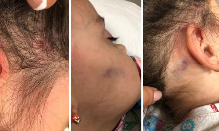 Anaokulunda akılalmaz olay!