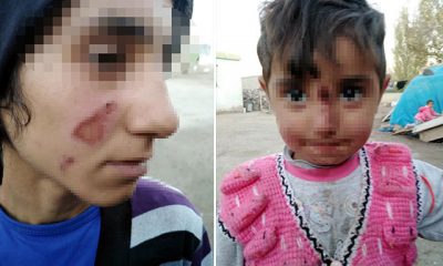 Eşi ve kızının yüzünü yaktı