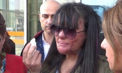 Yüzüne asit atılan Berfin duruşmaya ilk kez katıldı!