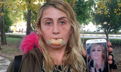 Güzellik uğruna hayatı karardı