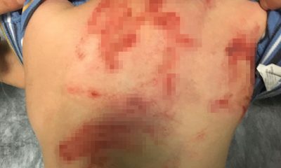 Küçük çocuğu darp ve cinsel istismar iddiasına tutuklama