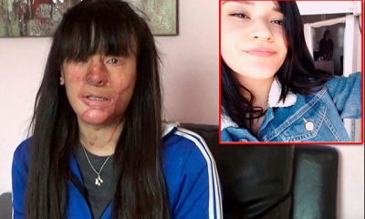 Berfin’e asitli saldırıda bulunan Casim Ozan Çeltik’e 13,5 yıl hapis