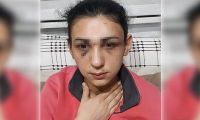 Eski eşinden şiddet gören kadın, sosyal medyadan yardım istedi