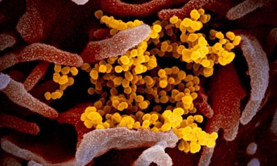 Covid-19’un (koronavirüs) fotoğrafları yayımlandı