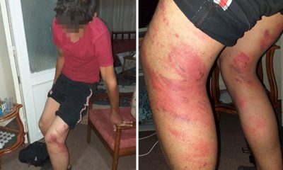 Triger kayışıyla dayak yedi, ‘İnsanlara olan inancım kalmadı’ dedi