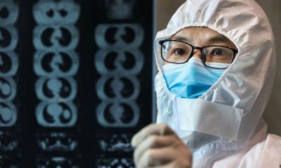 “Koronavirüsten kurtulan hastalarda kalıcı organ hasarı meydana gelebiliyor”