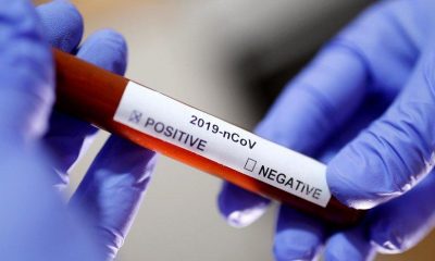 Interpol’den kritik Covid-19 uyarısı