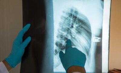 ABD’de ilk kez gerçekleşti!