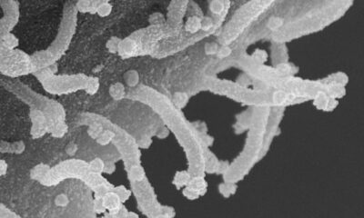 Covid-19 ilk kez böyle görüldü