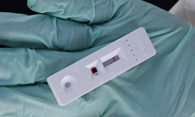 Bu test koronavirüsü saniyeler için tespit ediyor…