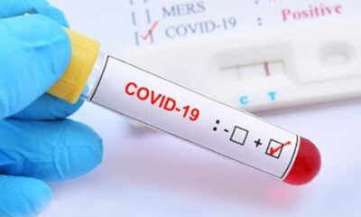 Corona virüsü verileri açıklandı!