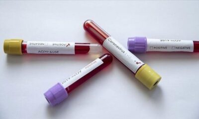 Sağlık Bakanlığı 24 Eylül corona virüsü verilerini açıkladı!