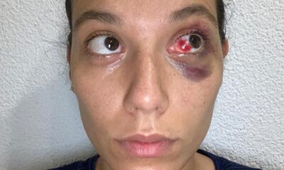 Deniz Bulutsuz’a da dava açıldı