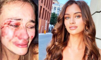 Model Daria Kyryliuk coronaya yakalandı