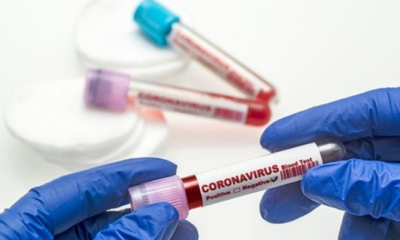 Sağlık Bakanlığı güncel corona virüsü verilerini açıkladı!