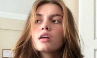 Aleyna Tilki hastanelik oldu