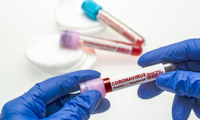 Güncel corona virüsü verileri açıklandı!