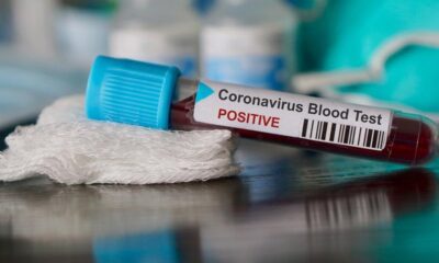 İstanbul Tabip Odası’ndan bakanlığa çağrı