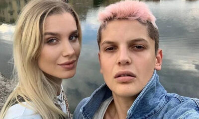 Ebrar Karakurt’un sevgilisi İmge’nin yüzündeki değişim dikkat çekti