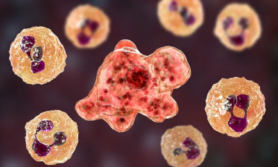 Korkunç olay… Yüzerken beyin yiyen amip bulaştı