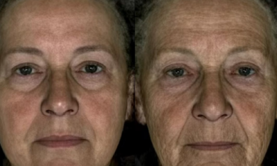 Bilimsel araştırma: Olduğundan yaşlı görünmek hastalık belirtisi olabilir