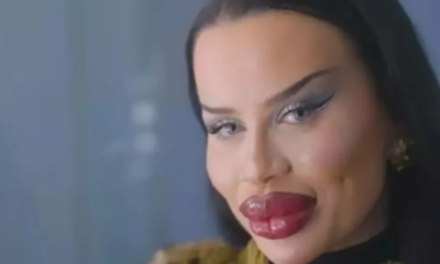 Estetik bağımlısı kadın 2 milyon TL verip yüzünü bu hale getirdi