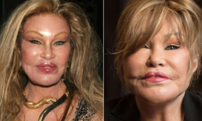 Servetini estetikle eriten ‘Kedi Kadın’ hayatını kaybetti