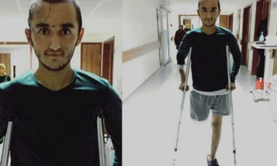 Gaziden açılım mesajı: Bacağımı geri verin