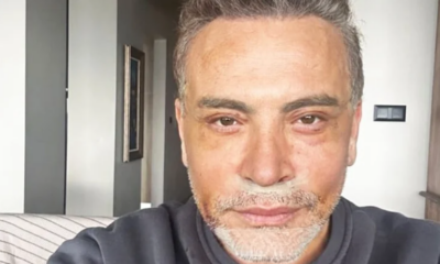 Cenk Eren estetik ameliyat olma nedenini açıkladı