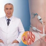 Uzmanı Anlattı: Kasık Fıtığında Ne Zaman Ameliyat Gerekir?