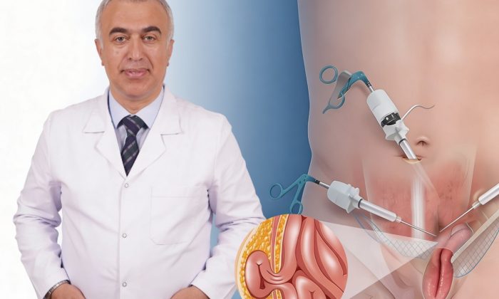 Uzmanı Anlattı: Kasık Fıtığında Ne Zaman Ameliyat Gerekir?